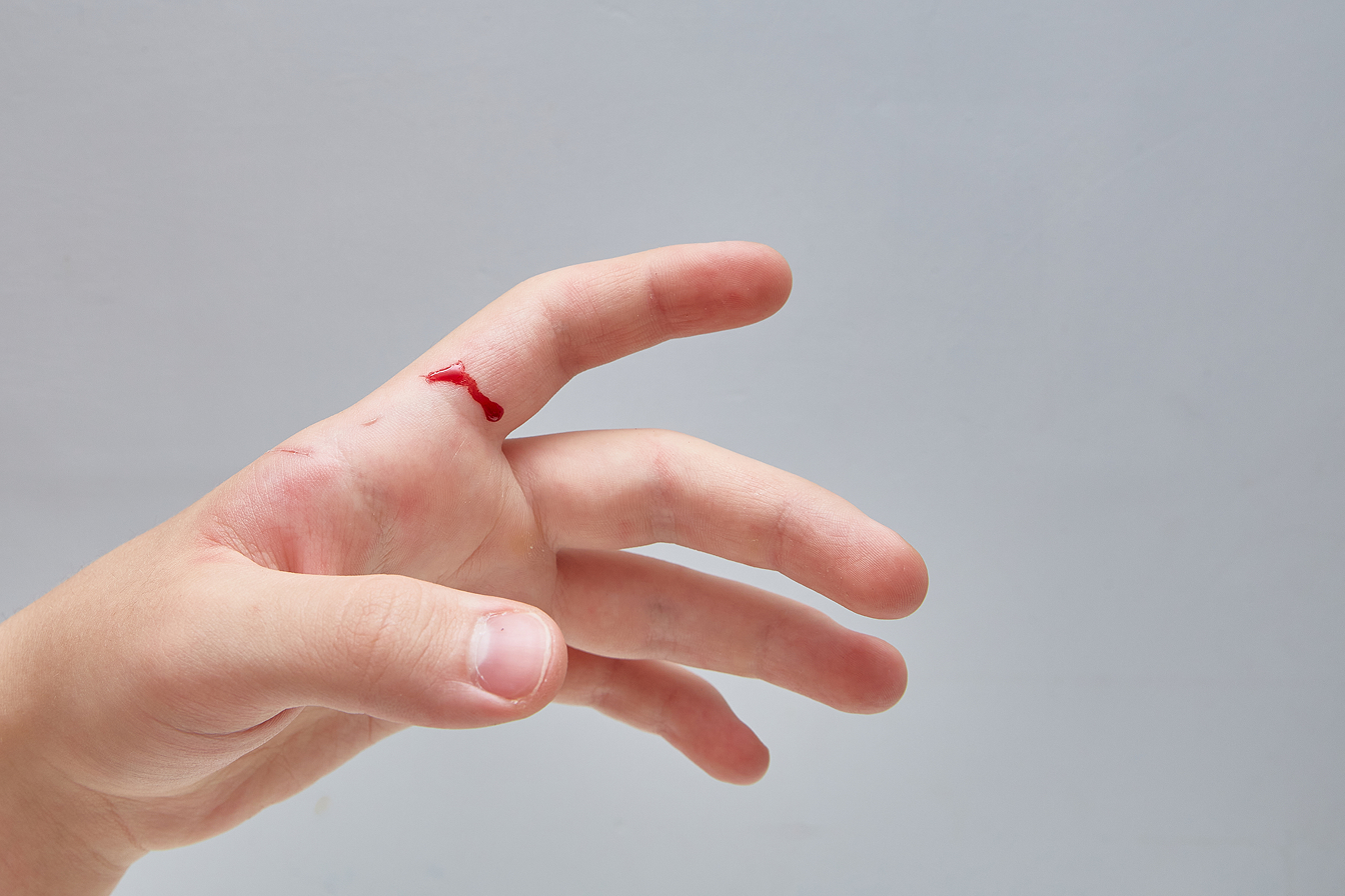 Ear Infections